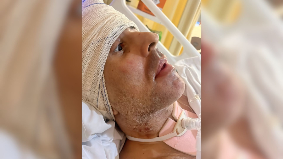 Comandante baleado sai da sedação, abre os olhos e emociona esposa: 